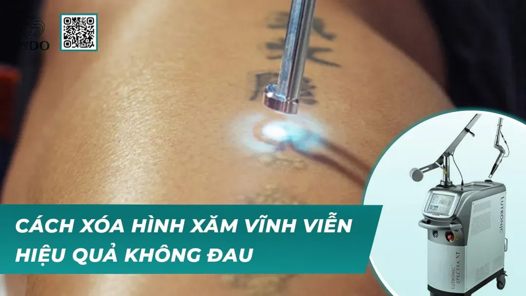 Cách xóa hình xăm vĩnh viễn hiệu quả không đau