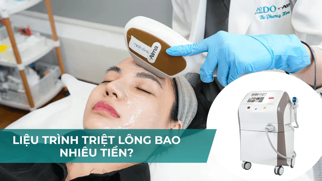 Liệu trình triệt lông bao nhiêu tiền? Bảng giá triệt lông chi tiết mới nhất
