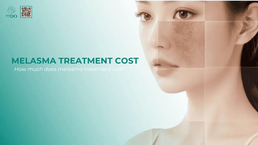 How much does melasma treatment cost?