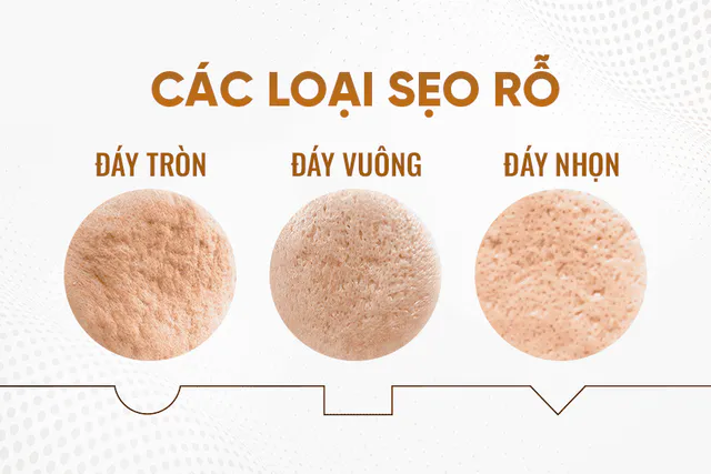 Types of Scars Suitable for TCA CROSS
