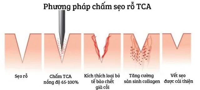 How TCA CROSS Works?