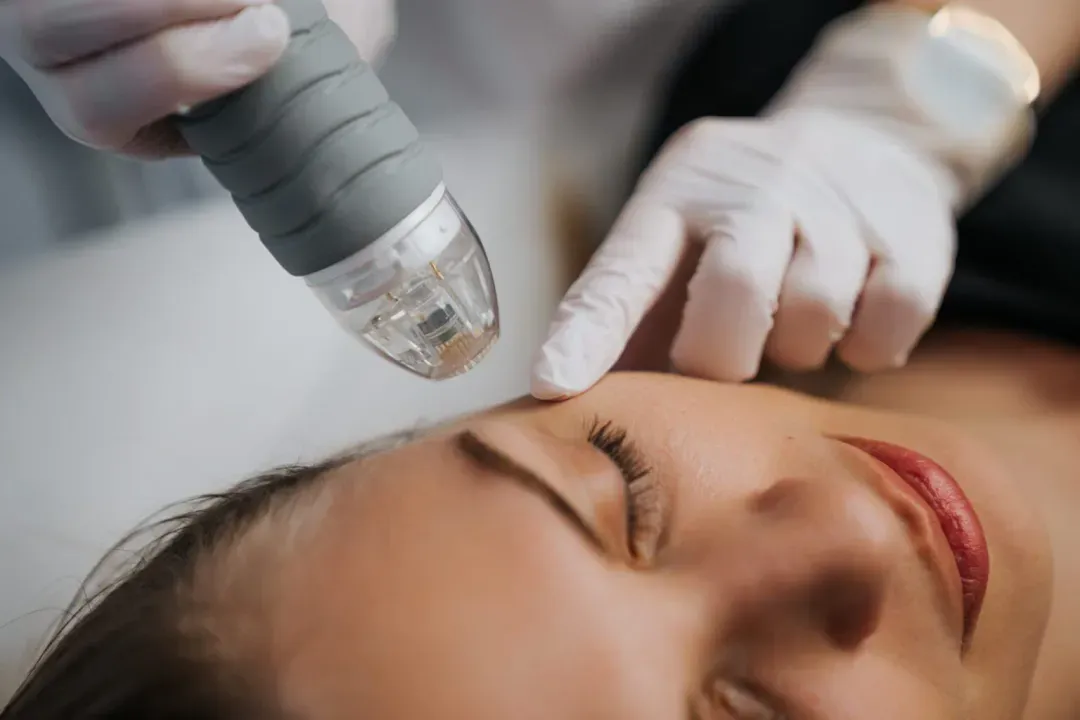 Đối tượng phù hợp với RF Needling