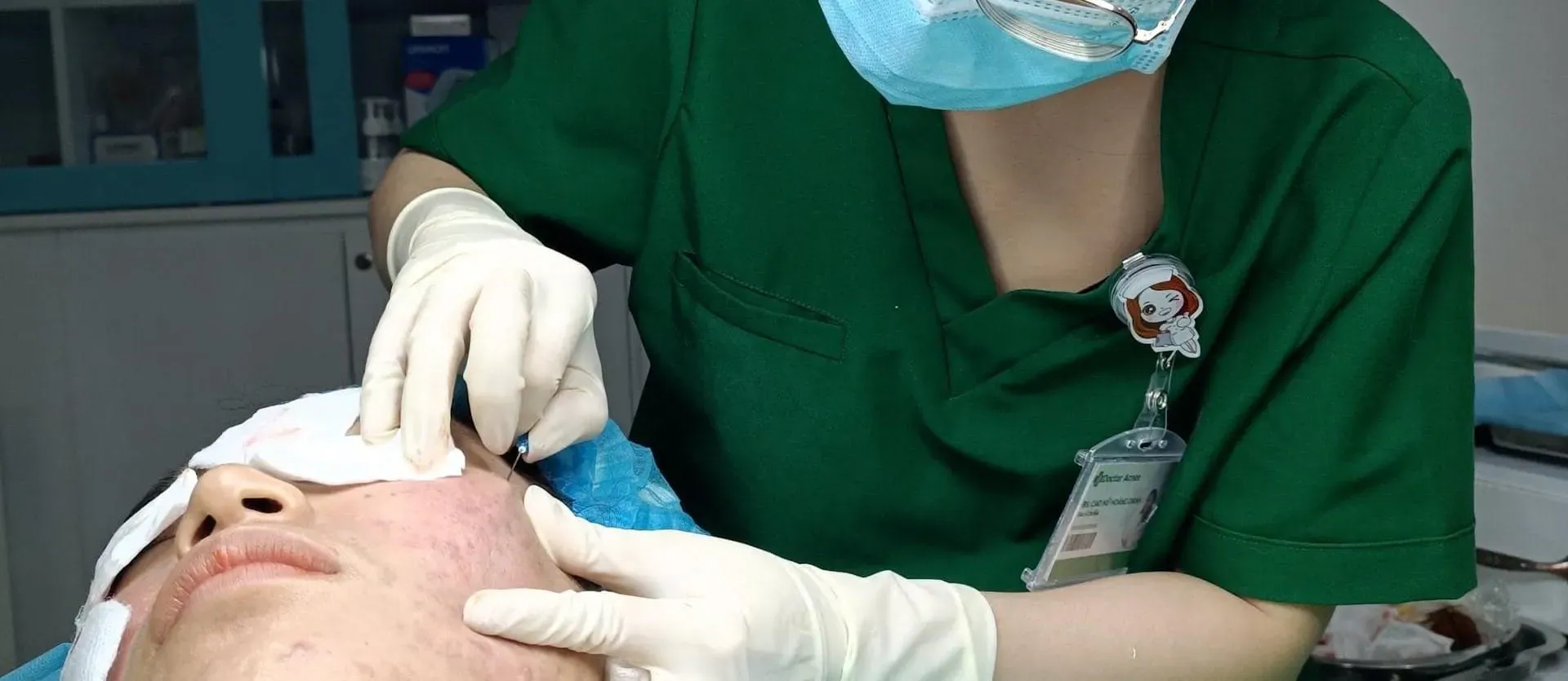 Các đối tượng phù hợp với phương pháp tách đáy sẹo