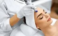Microneedling