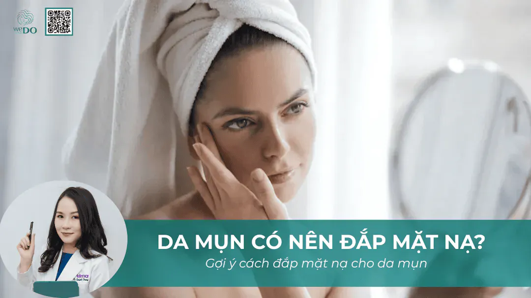 Bị mụn có nên đắp mặt nạ không?