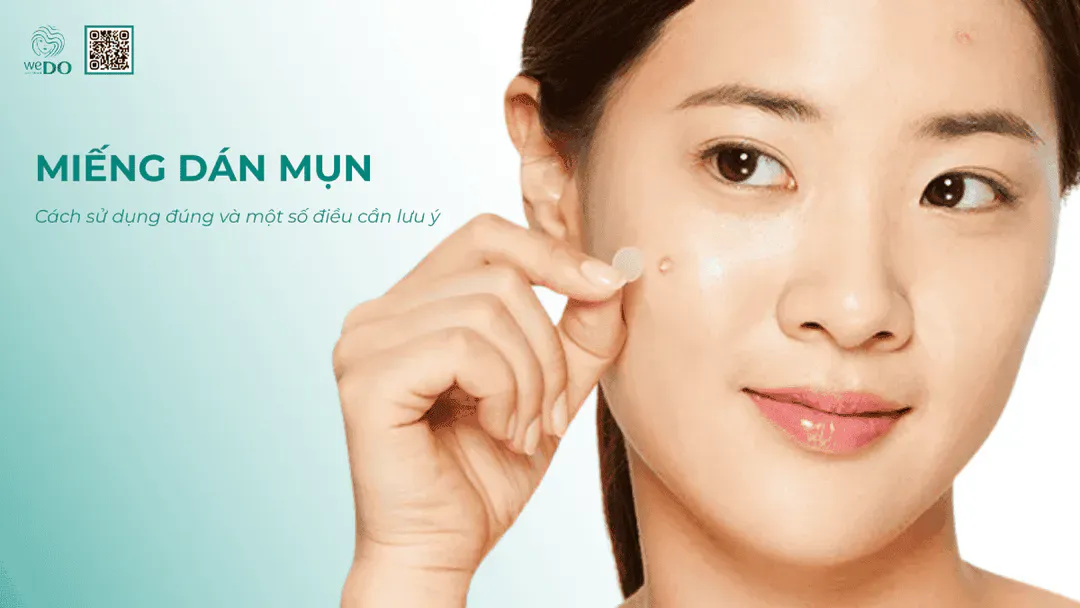 Cách sử dụng miếng dán mụn hiệu quả, gom cồi mụn nhanh