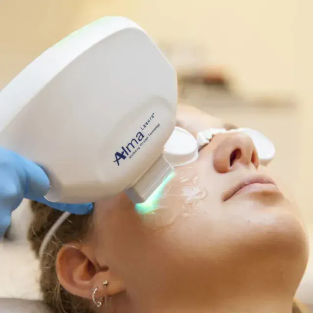 IPL — ánh sáng phổ rộng cho nền da đỏ