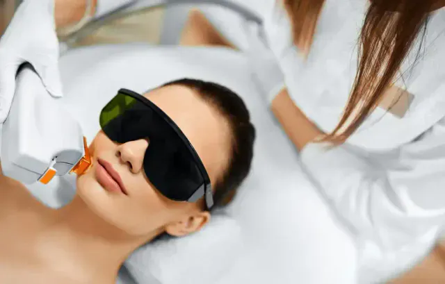 IPL giảm viêm, mờ thâm