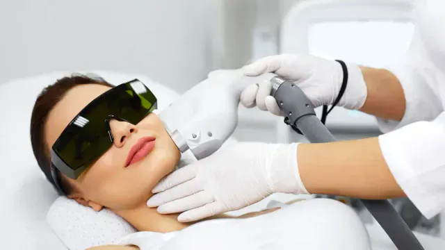 IPL — ánh sáng xung mạnh phổ rộng