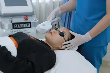 IPL for rosacea — broad-spectrum light on a red baseline