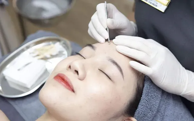 Medical acne extraction