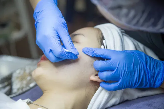 Why Is Acne Extraction Necessary?