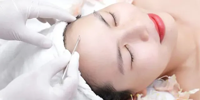 Tạo sao không nên tự ý nặn mụn tại nhà?