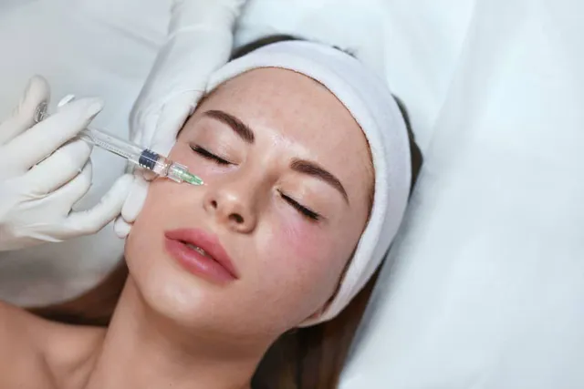 Tiêm meso cấp ẩm (mesotherapy vi điểm)