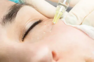 Skin booster HA – dưỡng chất giữ ẩm cho chất lượng da
