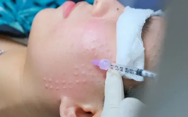 Chống chỉ định
