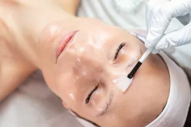 "Sự thật" về peel da hoá học