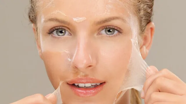 Giới thiệu về peel da hoá học