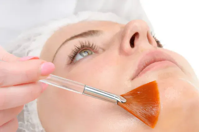 The Truth About Chemical Peels