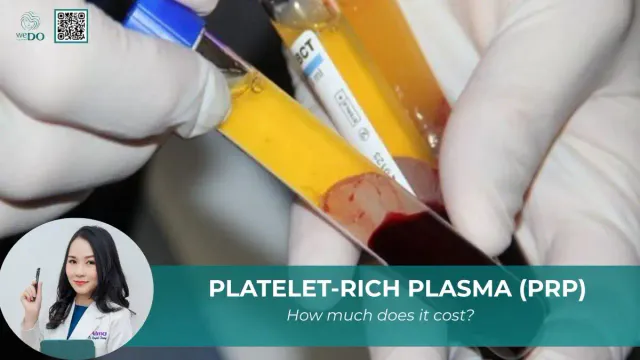 How Much Does PRP Injection Cost?