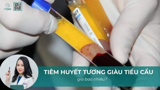 Tiêm huyết tương giàu tiểu cầu (PRP) giá bao nhiêu?