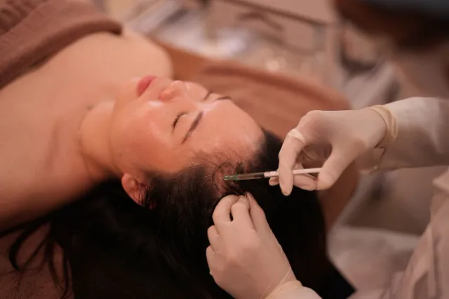 Mesotherapy for Hair Loss
