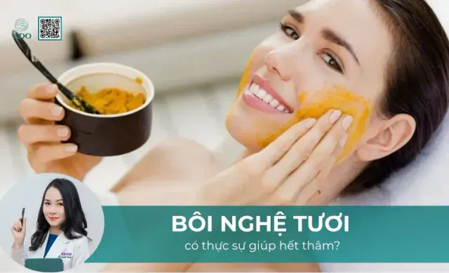 Bôi nghệ tươi có hết thâm không?
