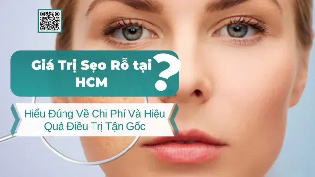 Giá Trị Sẹo Rỗ HCM: Hiểu Đúng Về Chi Phí Và Hiệu Quả Điều Trị Tận Gốc