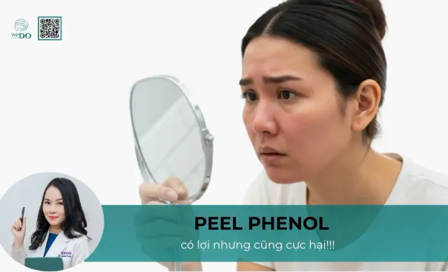 Peel Phenol – biện pháp làm đẹp cần cân nhắc cẩn thận