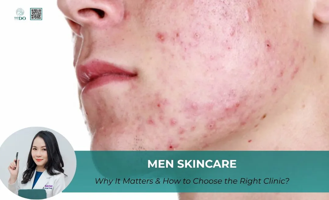 Men Skincare: Why It Matters & How to Choose the Right Clinic?