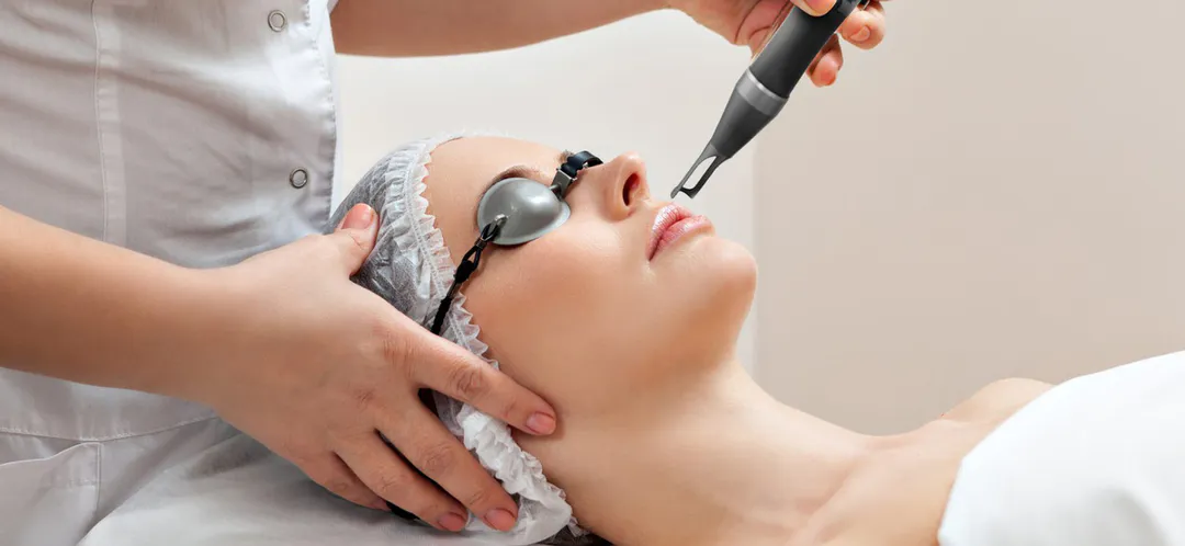 Pico Laser vs Q-Switched Laser for Melasma