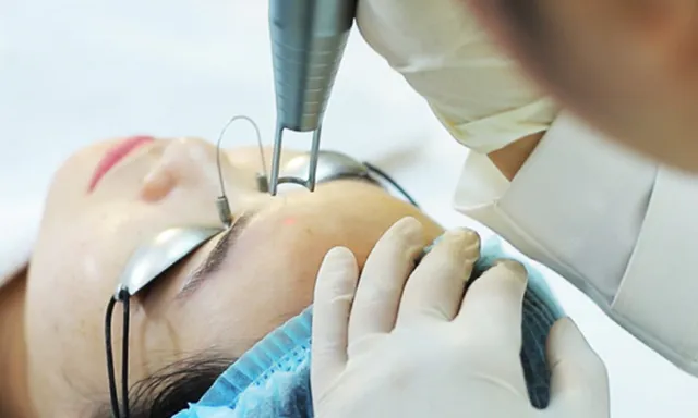 Melasma Treatment in HCM City