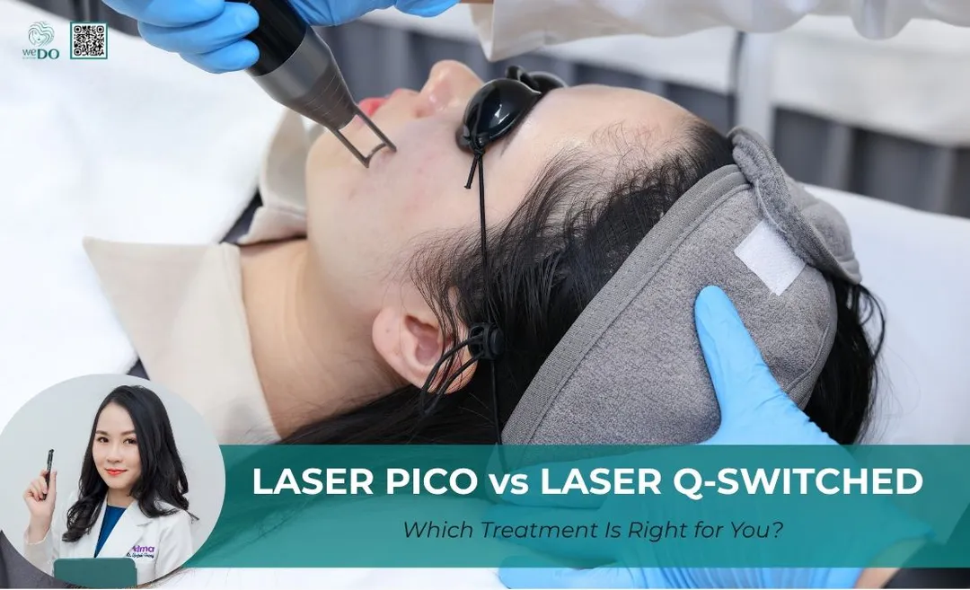 Pico Laser vs Q-Switched Laser for Melasma: Which Treatment Is Right for You?