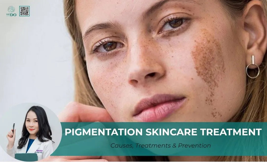 Pigmentation skincare treatment: Causes, Treatments & Prevention