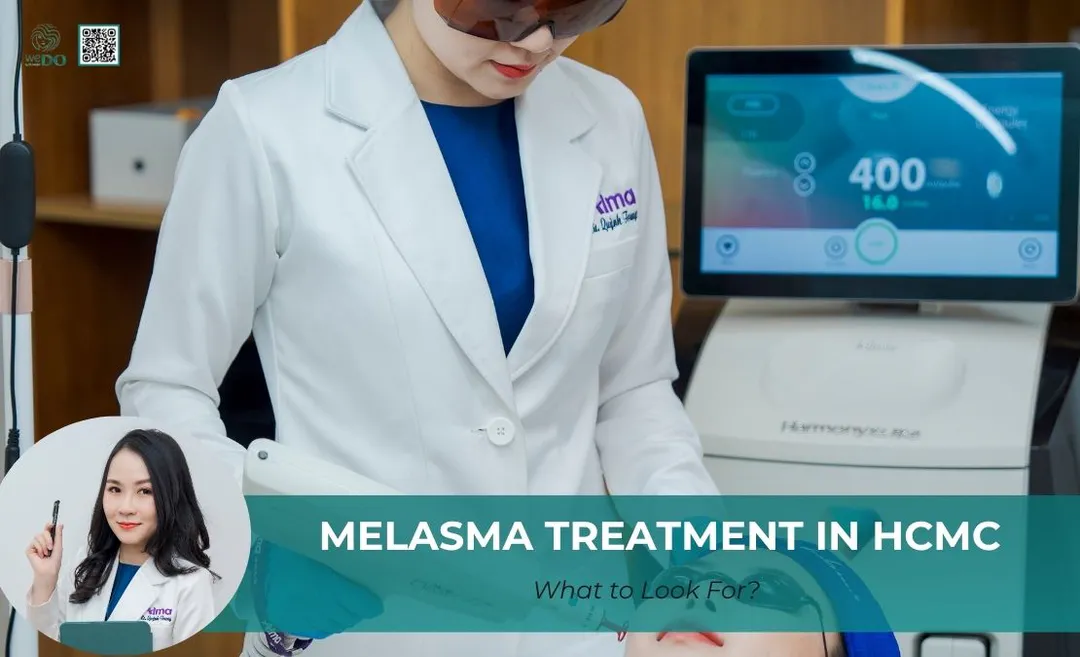 Melasma Treatment in Ho Chi Minh City: What to Look For?