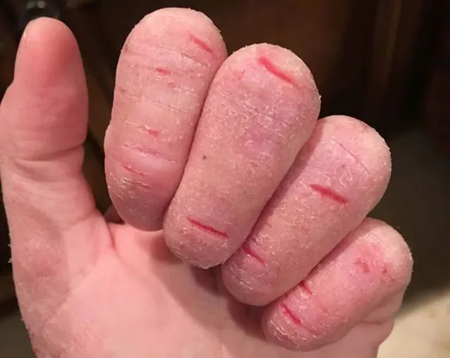 á sừng