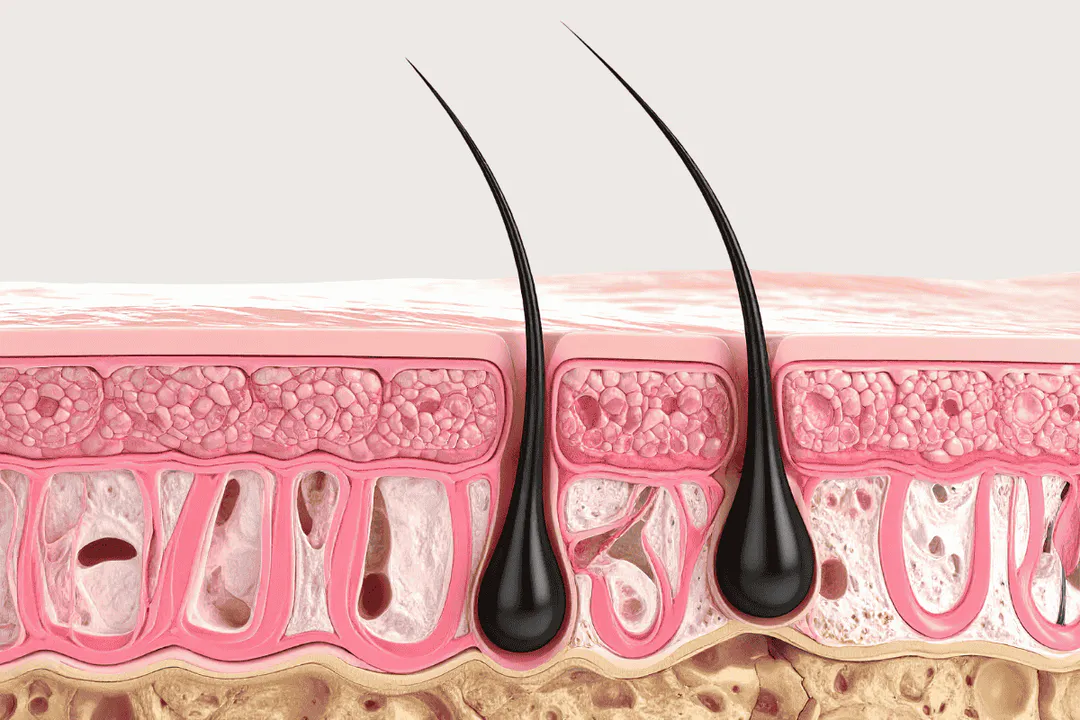 Nang tóc - sự hiện diện quyết định phương pháp điều trị