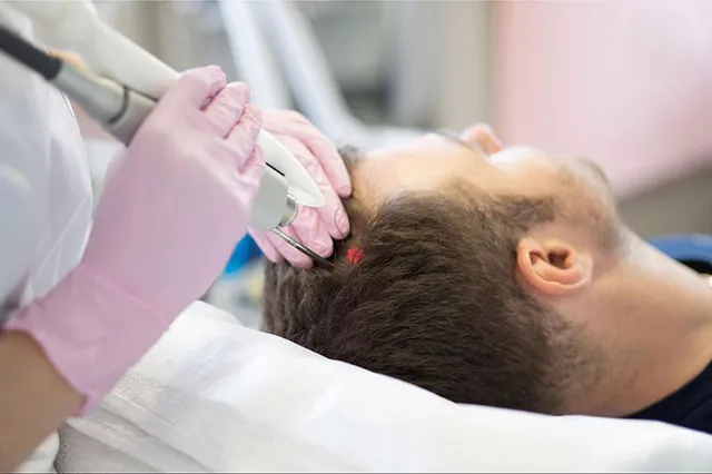 Cơ chế kích thích mọc tóc