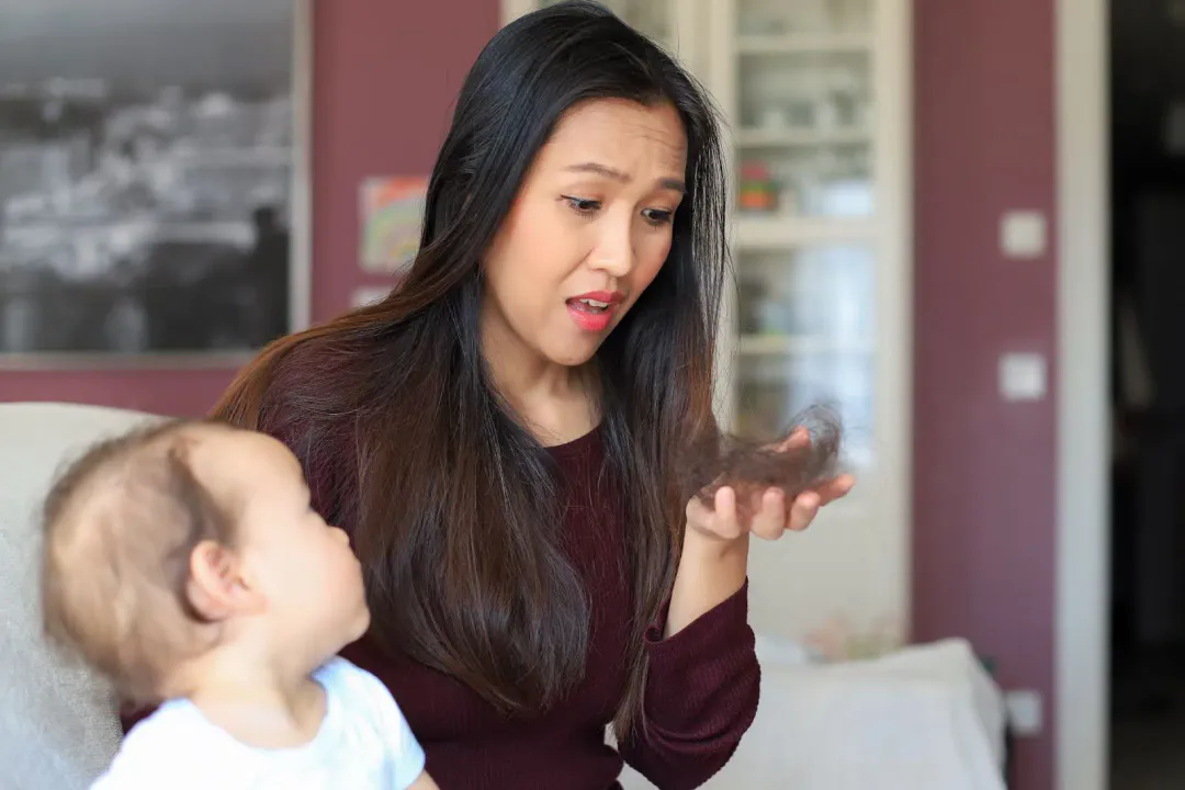 Rụng tóc sau sinh và rụng tóc kiểu nữ khác nhau như thế nào?