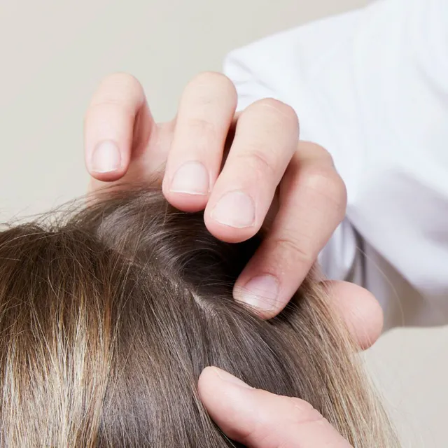 Khi nào rụng tóc sau sinh cần đi khám?