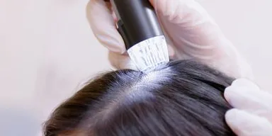 Tóc rụng nhiều ở nữ là bệnh gì? Những nguyên nhân bác sĩ kiểm tra trước
