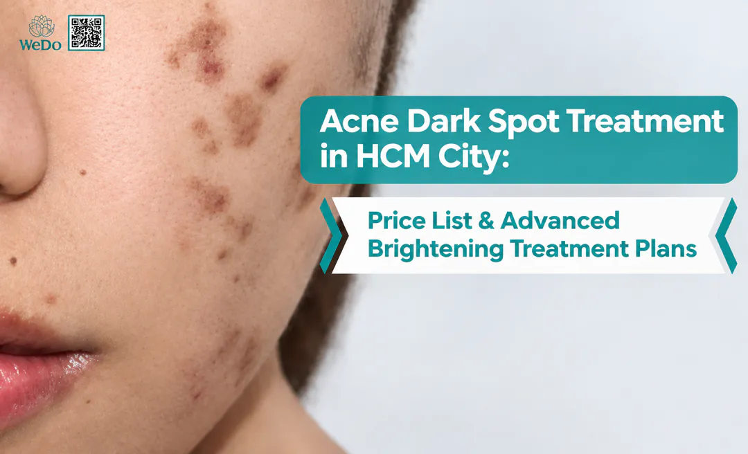 Acne Dark Spot Treatment in HCM City