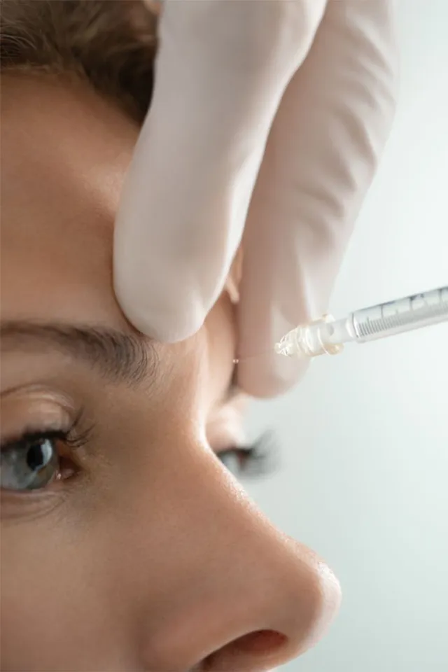 Botox Tại HCM