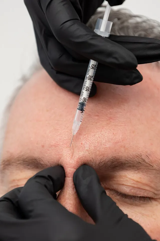 Botox in Ho Chi Minh City