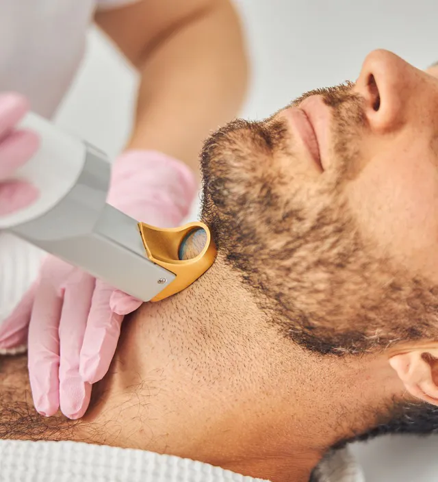 Laser Hair Removal Cost in HCM City