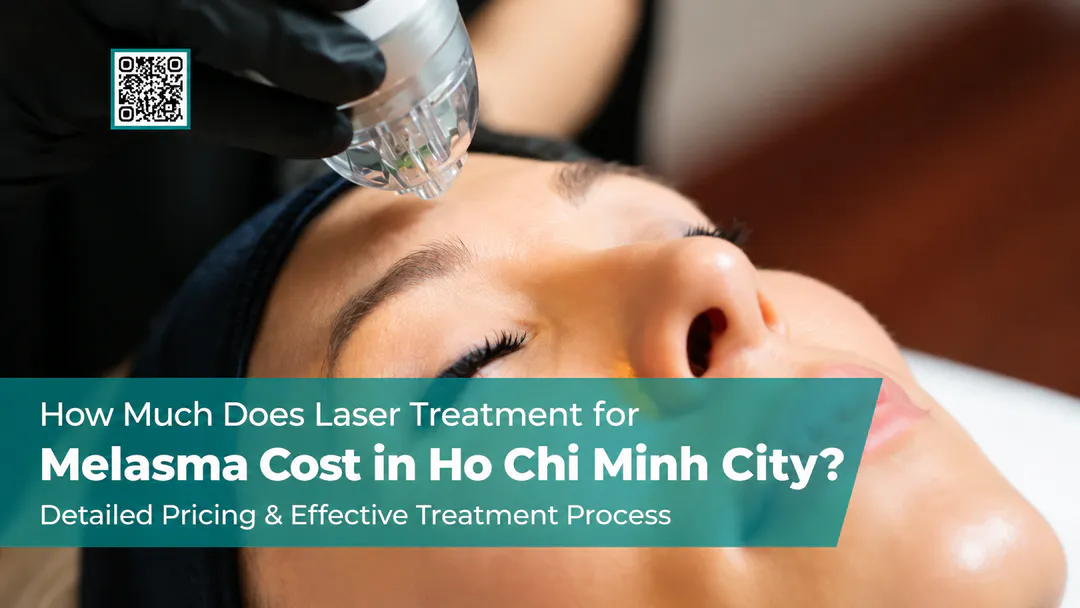 Laser Melasma Treatment Price in HCM City: Costs & Treatment Guide 2026