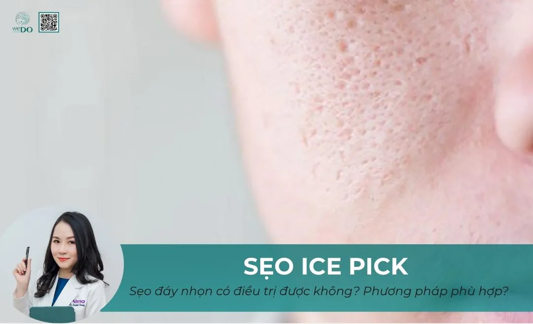 Sẹo ice pick có trị được không? Đâu là phương pháp phù hợp