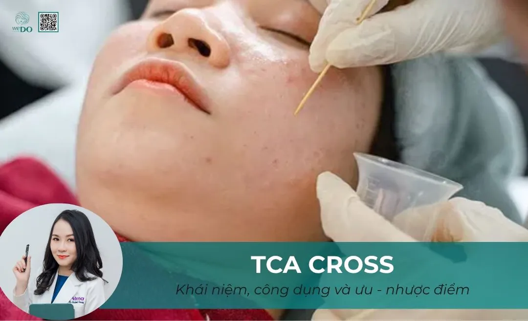 TCA Cross là gì? Tìm hiểu cơ chế, công dụng, ưu và nhược điểm