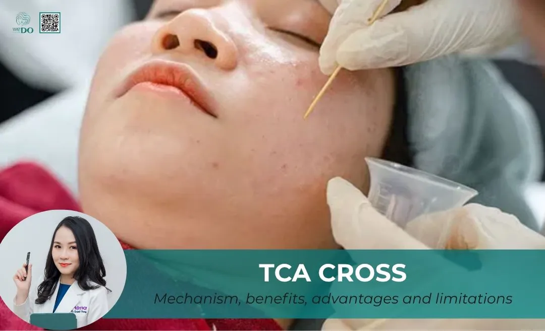 What is TCA CROSS? Mechanism, advantages and limitations