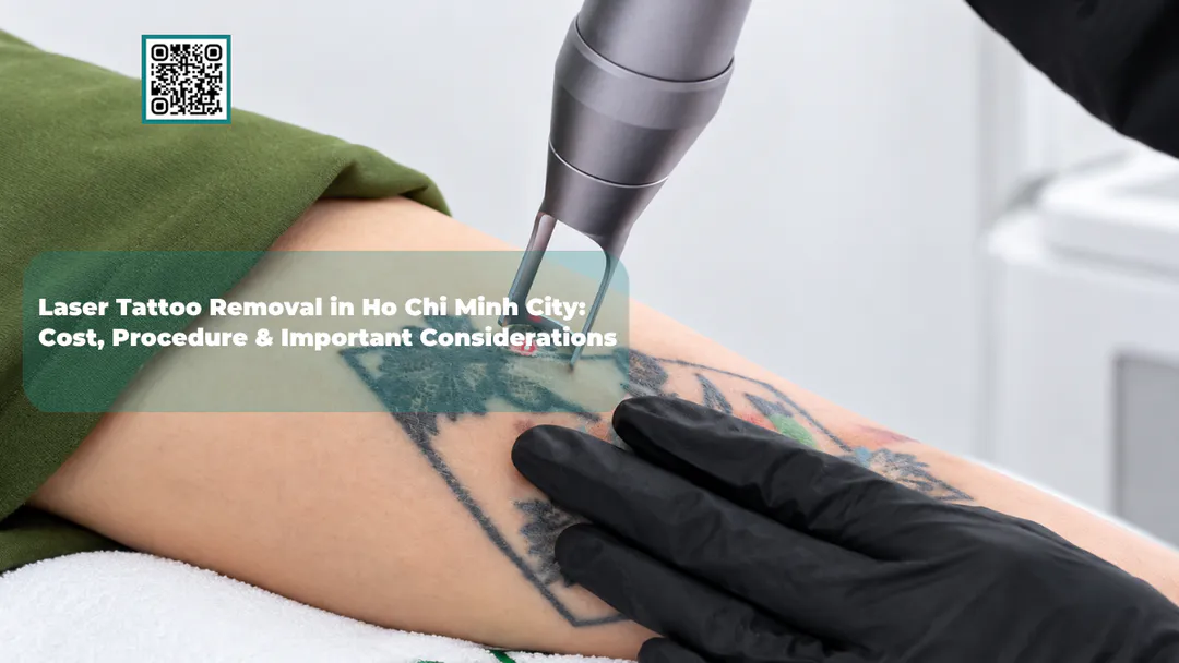 Laser Tattoo Removal in Ho Chi Minh City